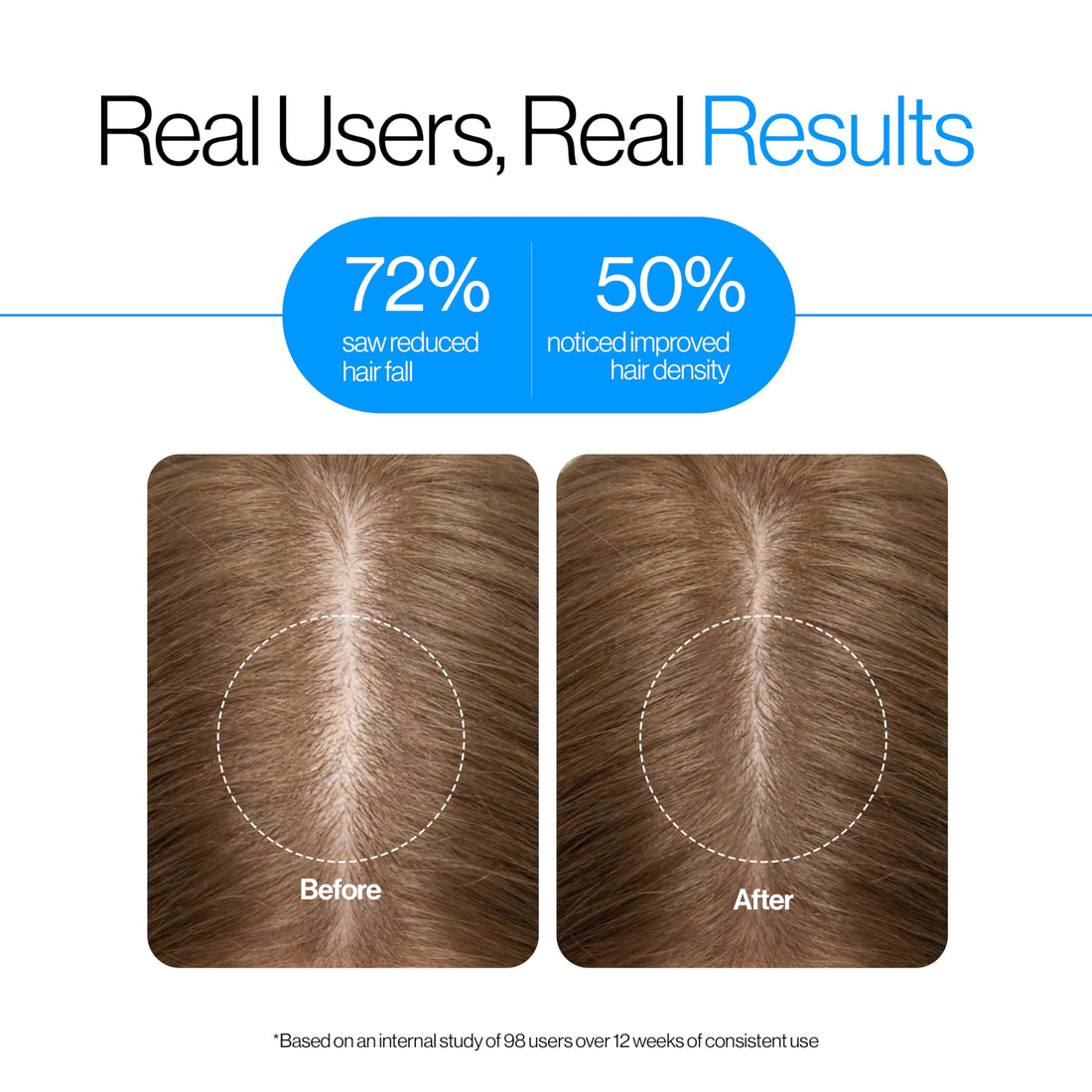 Be Bodywise Rosemary Hair Growth Serum (Roll On) | 3% Redensyl & 2% Anagain | Hair fall control serum for Women & Men | Promotes Hair Growth & Stimulates Hair Follicles | For All Hair Types | 25ml
