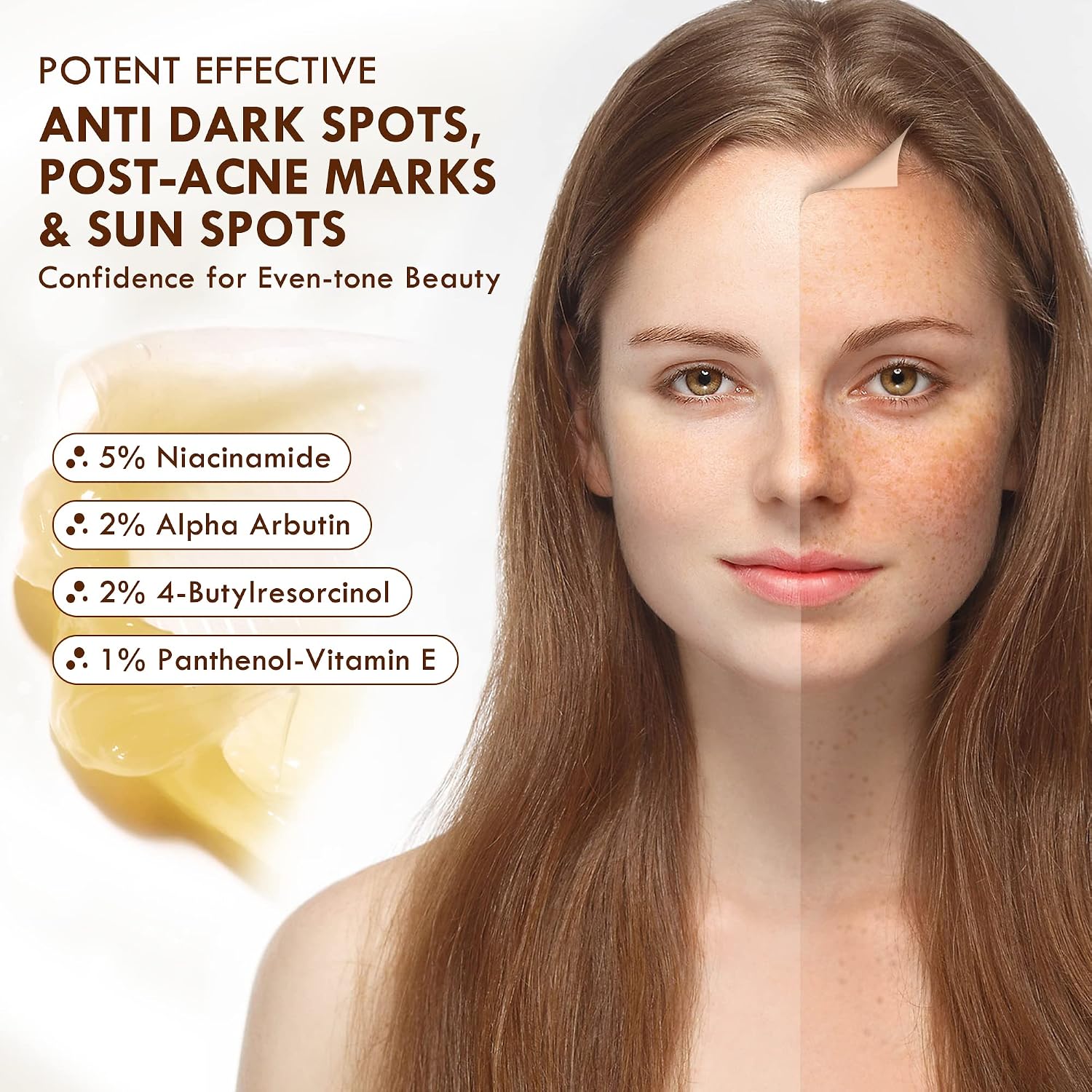 Dark Spot Remover for Face and Body, Age Spot Remover for Face, Dark Spot Corrector Freckle Remover, Sunspots and Melasma with 2% Alpha Arbutin, 5% Niacinamide, 50 ml Halalzen