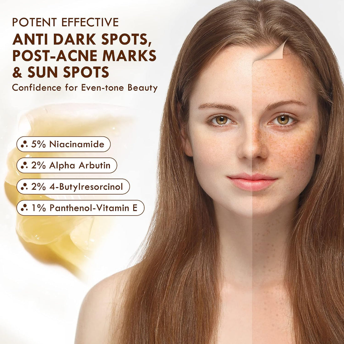 Dark Spot Remover for Face and Body, Age Spot Remover for Face, Dark Spot Corrector Freckle Remover, Sunspots and Melasma with 2% Alpha Arbutin, 5% Niacinamide, 50 ml Halalzen