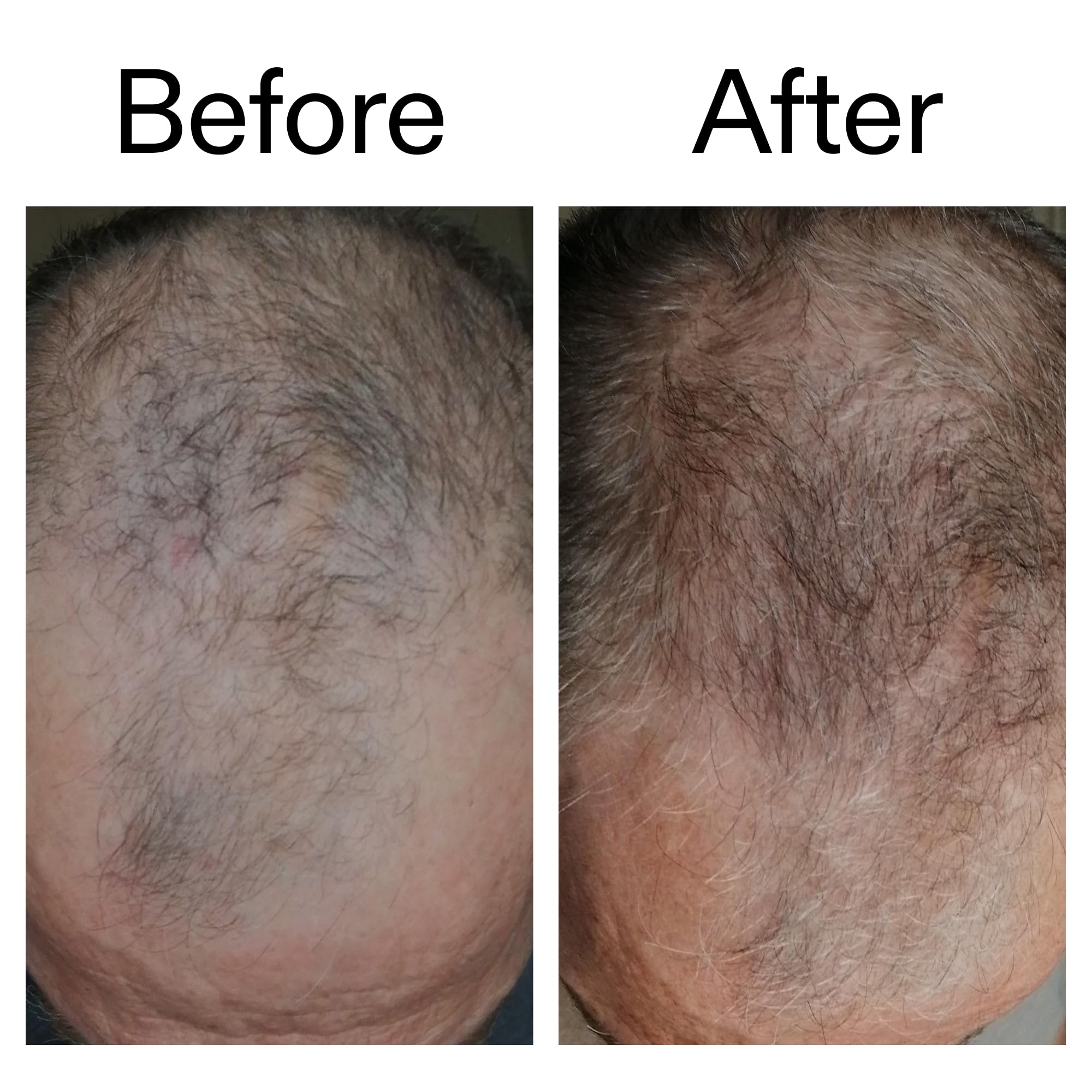 The INKEY List 1% Caffeine Stimulating Scalp Hair Loss Reduction Serum Overnight Treatment 150ml