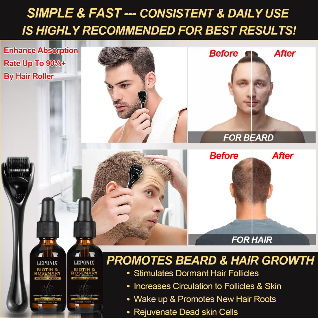 Rosemary Oil for Hair Growth, Diluted Rosemary Oil Hair Growth Serum with Derma Roller & Scalp Massager Hair Thickening Products Hair Loss Treatment for Men Women, Mens Gift Set