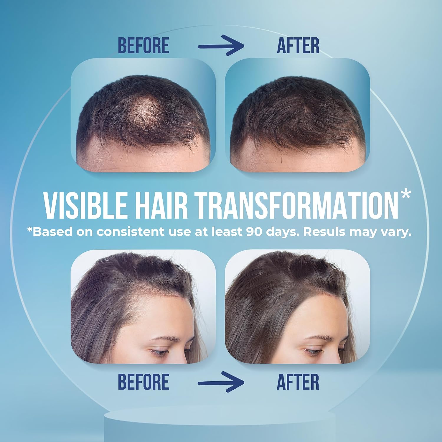 Hair Serum for Hair Loss & Thinning Hair – Natural Vegan Hair Growth Treatment with Panthenol, Vitamin E & Allantoin – Sulfate Free Scalp Soothing Leave-In Serum for Men & Women