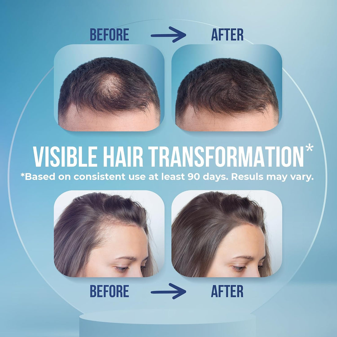 Hair Serum for Hair Loss & Thinning Hair – Natural Vegan Hair Growth Treatment with Panthenol, Vitamin E & Allantoin – Sulfate Free Scalp Soothing Leave-In Serum for Men & Women