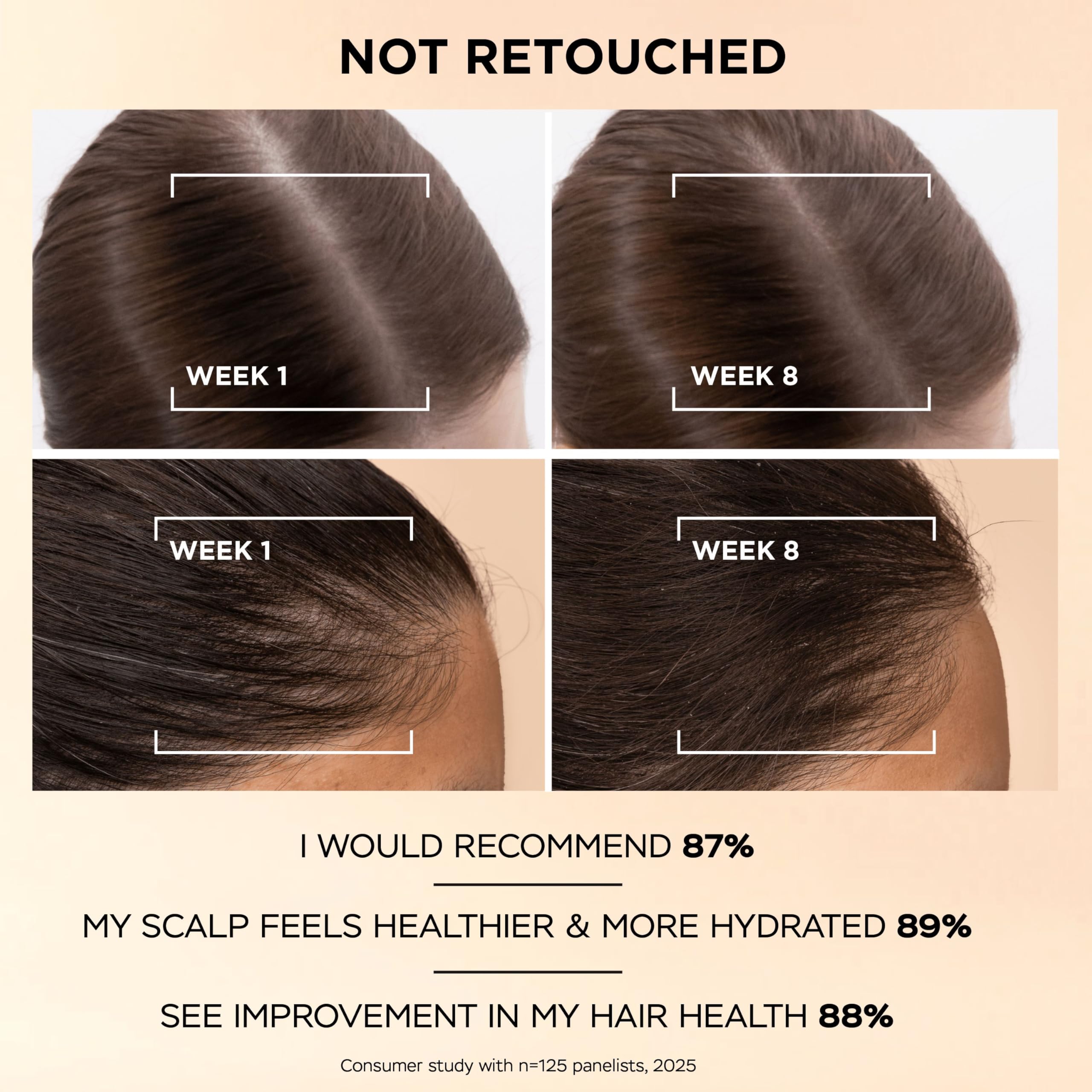 Pantene Grow Abundant Anti-Hair Loss Scalp Serum 60ml for Thicker, Longer, Denser Hair in 8 Weeks. Increases Density & Reduces Hair Loss. With 3000 Pro-Vitamin Complex & Niacinamide
