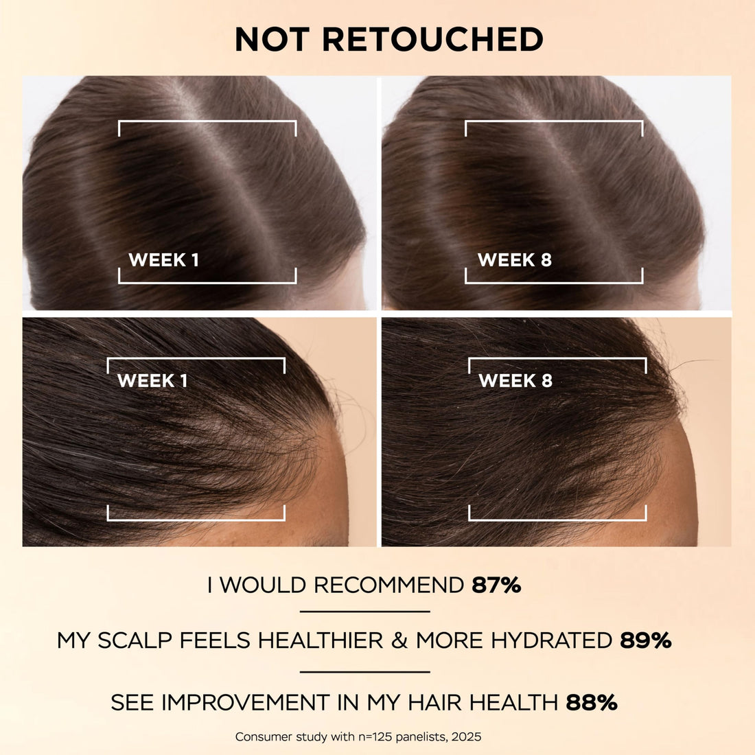 Pantene Grow Abundant Anti-Hair Loss Scalp Serum 60ml for Thicker, Longer, Denser Hair in 8 Weeks. Increases Density & Reduces Hair Loss. With 3000 Pro-Vitamin Complex & Niacinamide