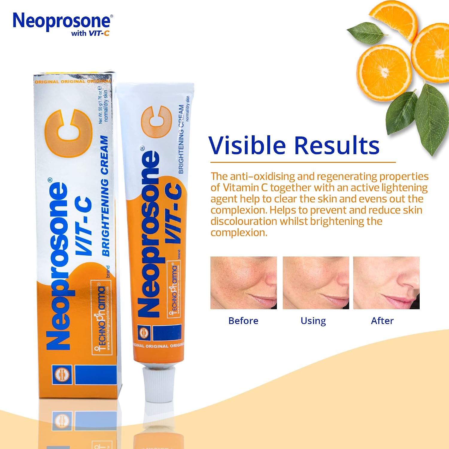 Neoprosone, Skin Brightening Cream - 1.7 fl oz / 50g - Helps to Fade Dark Spots on Face, Armpit, Elbows, Knees and Neck - with Vitamin C and Alpha Arbutin Complex
