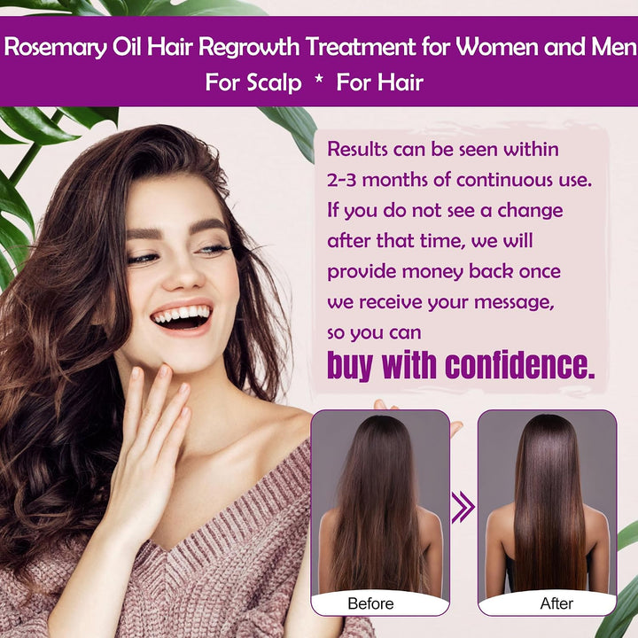 GIFBEA Rosemary Oil Serum for Hair Growth W/Rosemary Water & Rice Water Spray Hair Growth,Biotin Castor Oil Argan Oil Caffeine Keratin Reduce Hair Loss,Hair Thickening Products Treatment for Women Men Halalzen