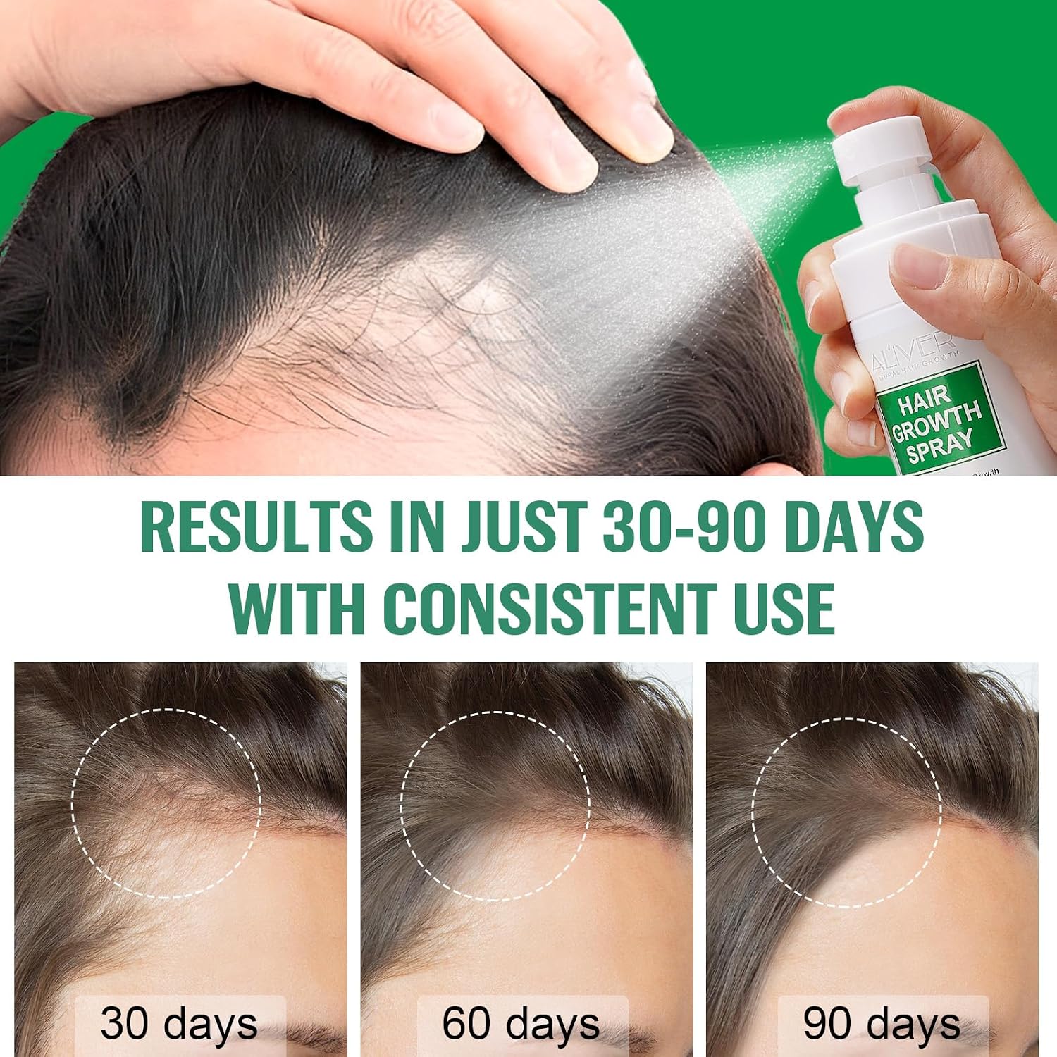 Hair Growth Serum Spray 120ml with Biotin, Rosemary & Castor Oil - Natural Hair Loss Treatment & Thickening Scalp Care with Batana Oil, Caffeine & Ginseng - For Women & Men, All Hair Types
