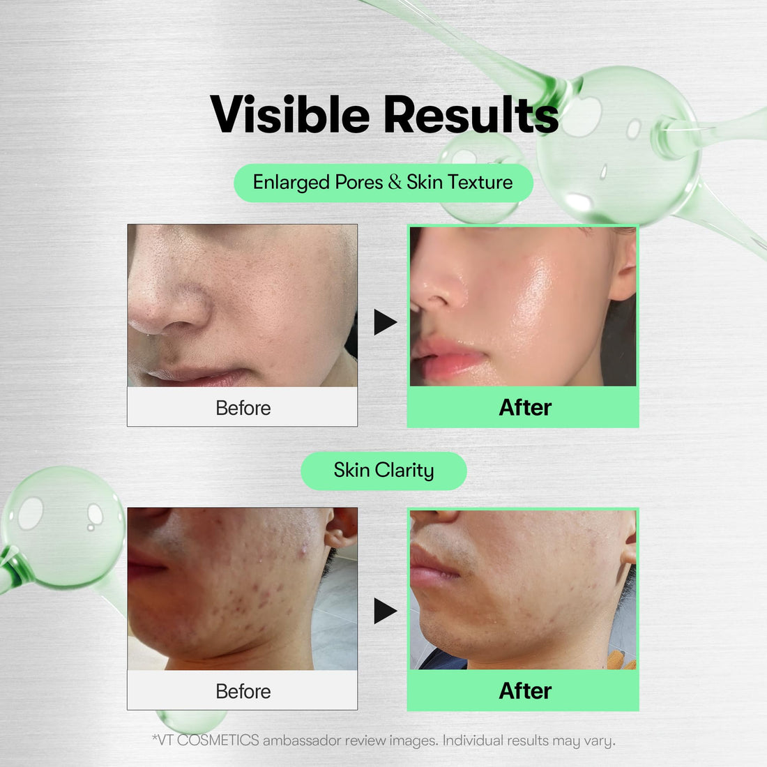 VT COSMETICS CICA Reedle Shot 300, Spicule Microneedling Serum for Pore Care & Exfoliation, Exosome & Centella Asiatica for Glass Skin, Smooth Skin Texture, Korean Skin Booster (1.69 Fl Oz / 50ml) Halalzen