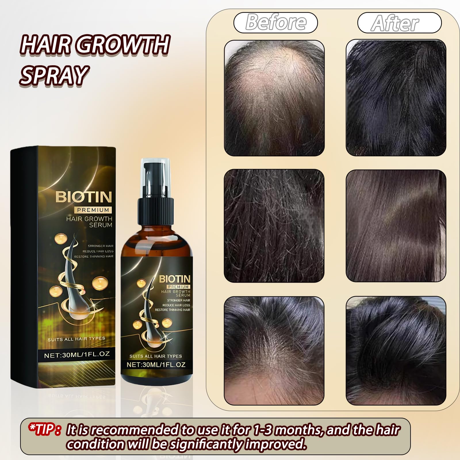 Anti Hair Loss Serum, Hair Growth Serum, Thinning Hair Regrowth Oil, Biotin Oil For Hair Growth, Nourishes, Loss Treatment For Men & Women Strengthens & Lengthens