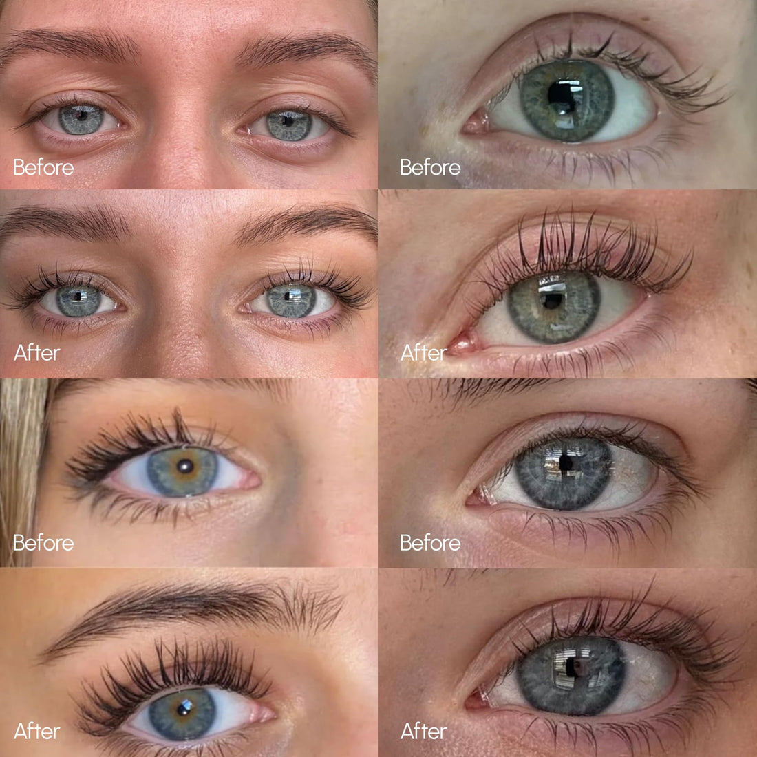 ByBabes Lash CEO Eyelash Growth Serum | Prostaglandin-Free Rapid Brow & Lash Serum For Growth, Lift & Thickness | See Fuller Looking, Healthier Eyebrows & Eyelashes In 4-6 Weeks | UK Made