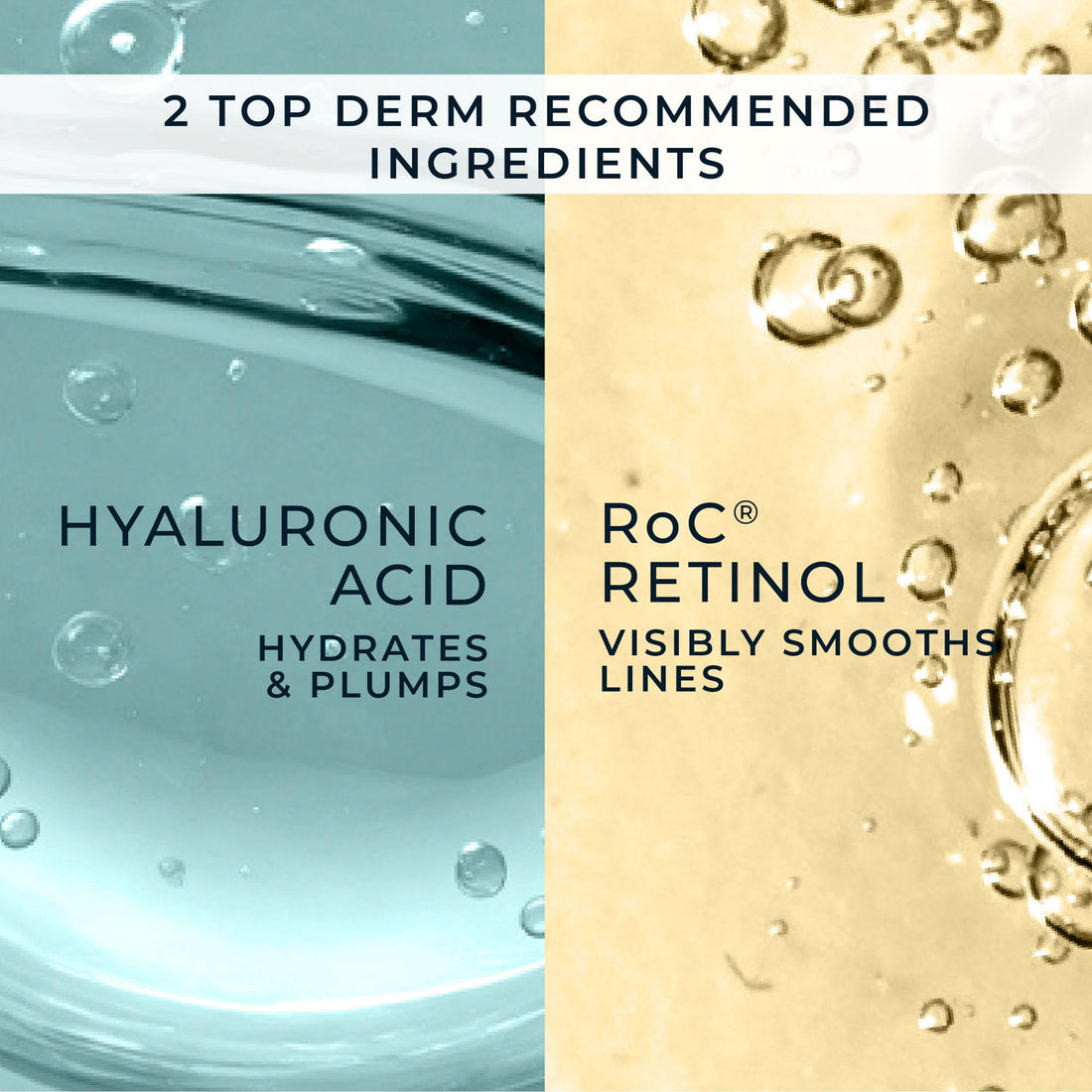 RoC Retinol Correxion Line Smoothing Eye Cream | For Wrinkles, Dark Circles & Puffy Eyes | 15 ml