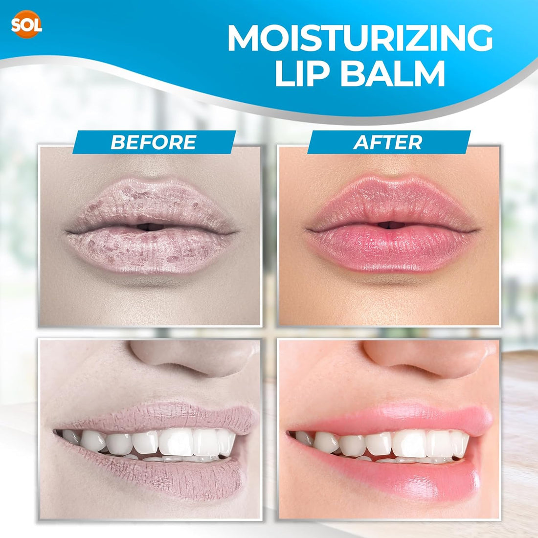 SOL 14pk Unscented Lipbalm Multipack - Moisturiser & Hydrating Lip Balm for Men and Women, Repair for Dry, Chapped Lips With Vitamin E, Long-Lasting Lip Care Sticks for Home, Office, or On-the-Go Use