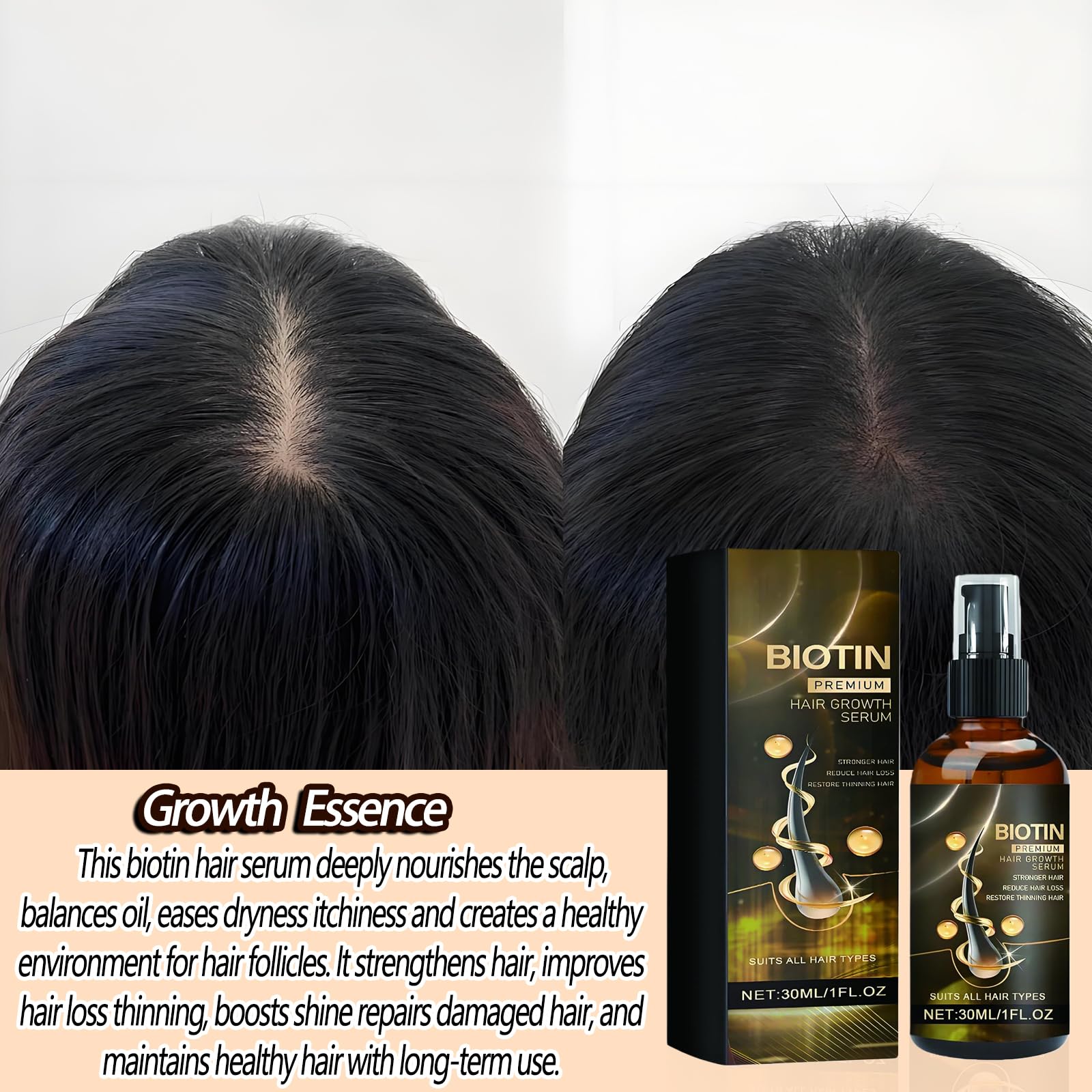 Anti Hair Loss Serum, Hair Growth Serum, Thinning Hair Regrowth Oil, Biotin Oil For Hair Growth, Nourishes, Loss Treatment For Men & Women Strengthens & Lengthens