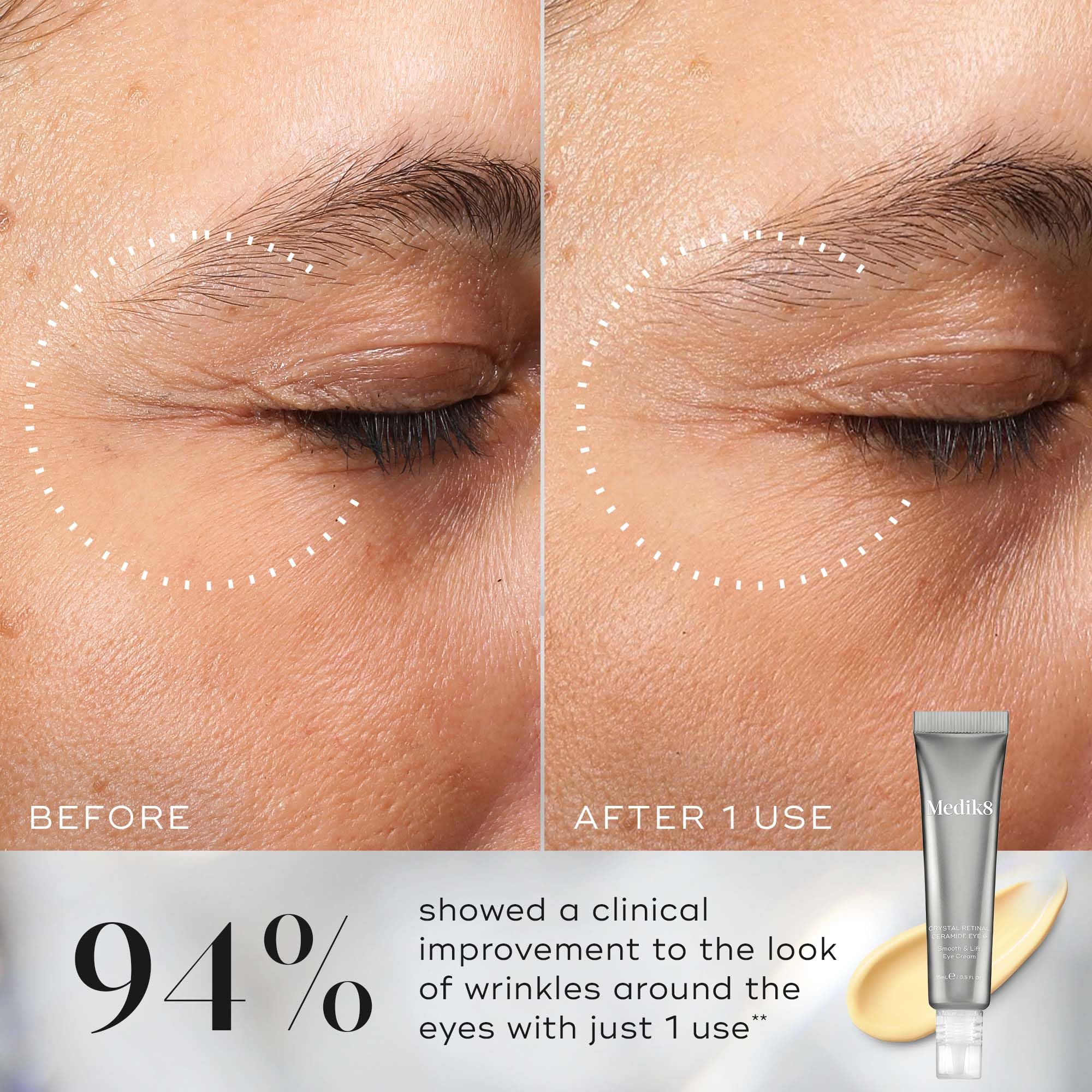 Medik8 Crystal Retinal Ceramide 3 Eye Cream - Anti Ageing & Anti Wrinkle - Smooth & Lift Eye Cream - 0.03% Retinal Strength - 11x Faster than Retinol - For New Vitamin A Users - 15ml