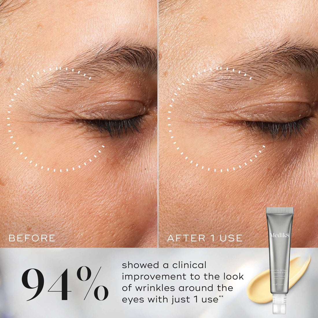 Medik8 Crystal Retinal Ceramide 3 Eye Cream - Anti Ageing & Anti Wrinkle - Smooth & Lift Eye Cream - 0.03% Retinal Strength - 11x Faster than Retinol - For New Vitamin A Users - 15ml