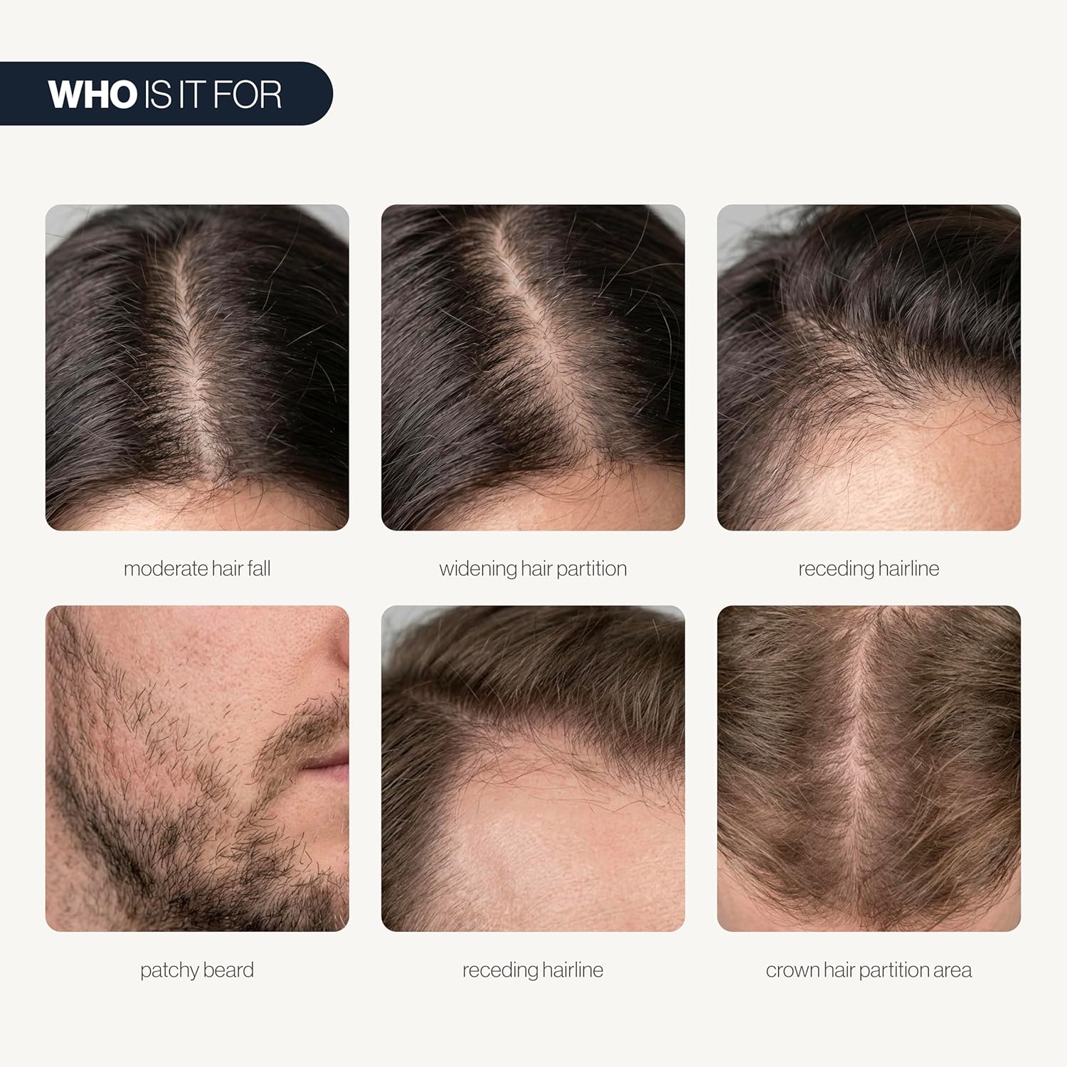 Be Bodywise Hair Growth Serum Roll On - 5% Saw Palmetto, 3% Rosemary Oil for Hair Growth, 3% Fenugreek,1% Caffeine Herbasome | Serum for Hair Loss & Hair Regrowth For Men & Women 25ml/0.84 fl oz Halalzen