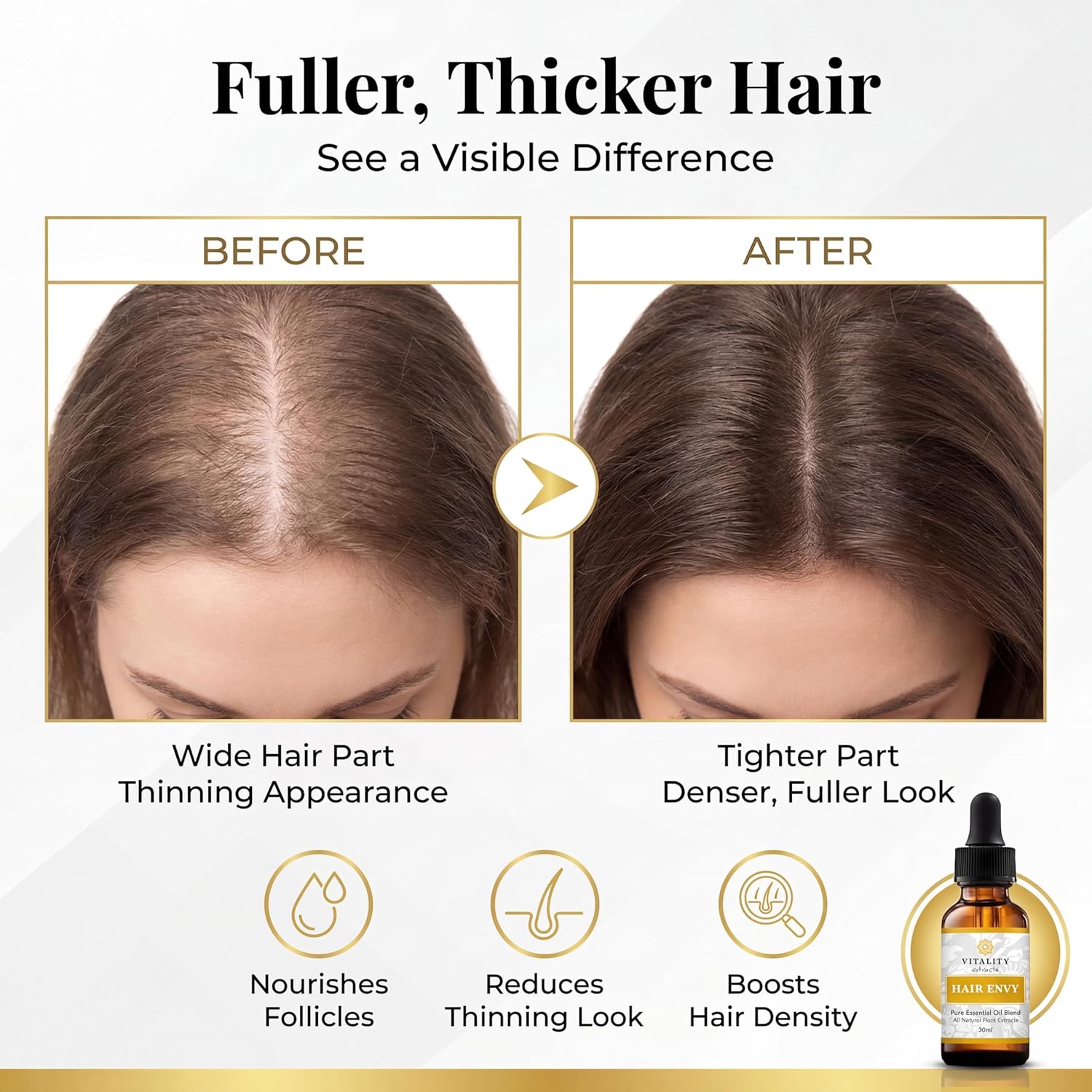 Vitality Extracts Hair Envy - Sérum naturel pour la pousse des cheveux - Huiles essentielles 100 % pures, 15 extraits de plantes, sans produits de synthèse, sans parabènes - Fortifie les cheveux, minimise la casse, stimule les follicules