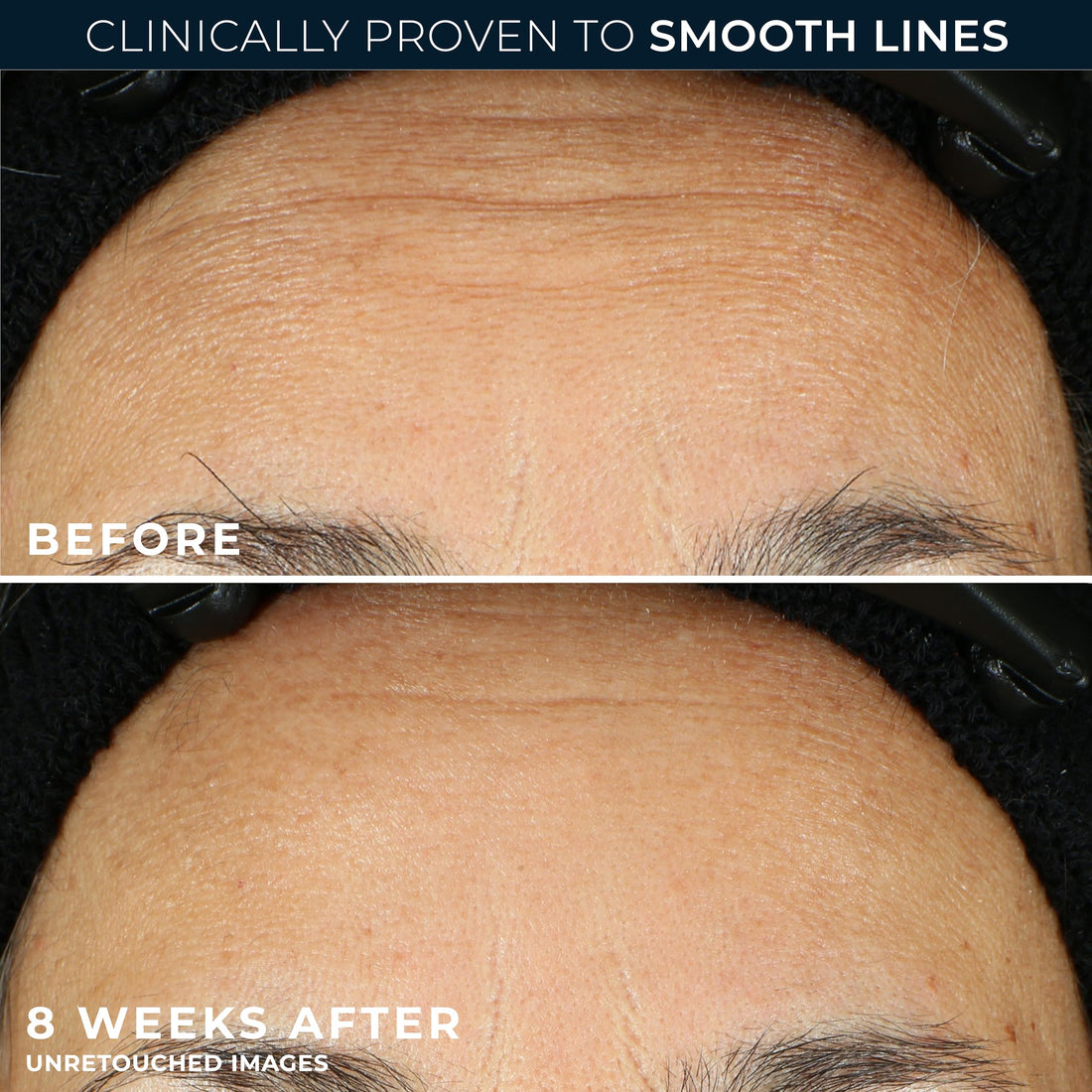 RoC Retinol Correxion Line Smoothing Eye Cream | For Wrinkles, Dark Circles & Puffy Eyes | 15 ml