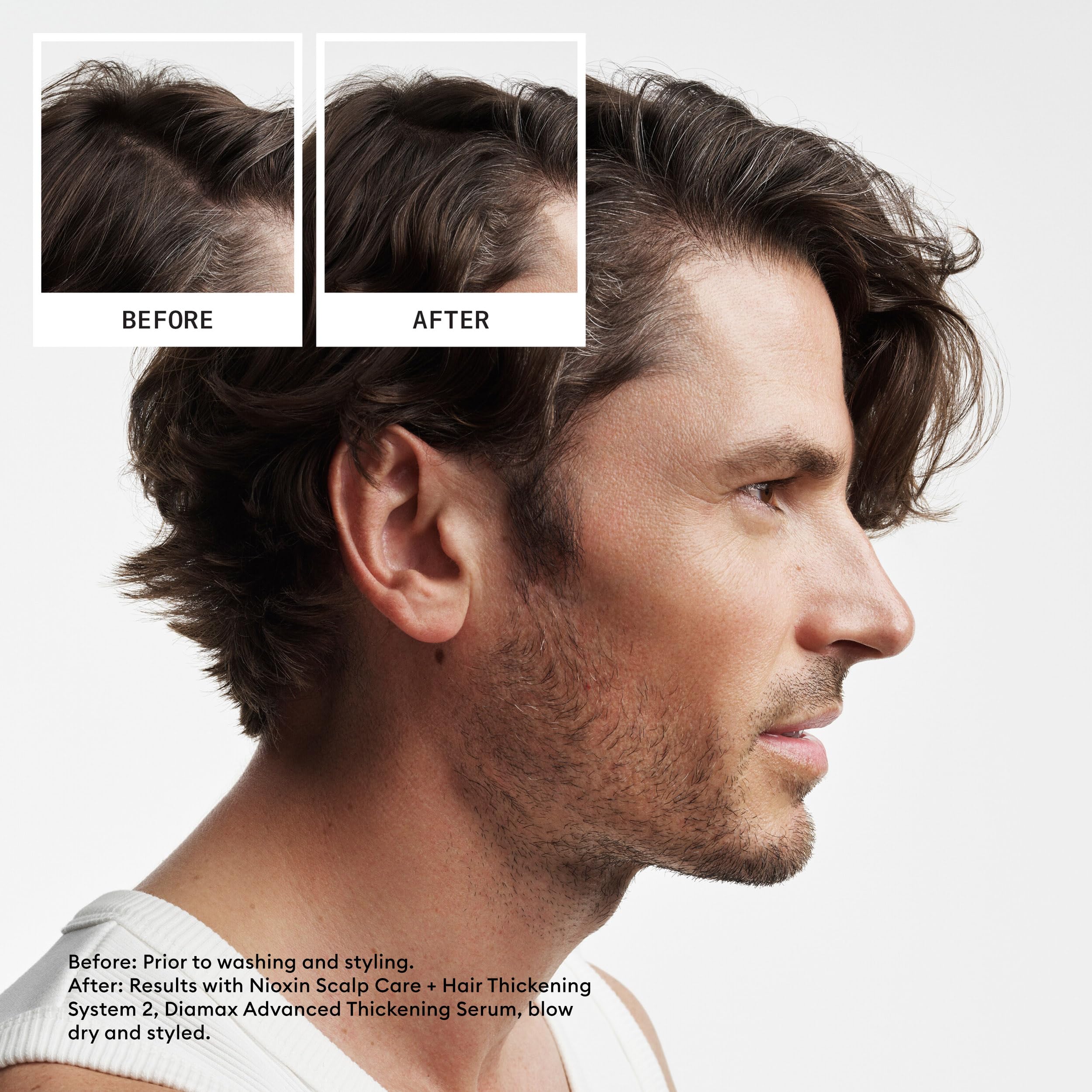 Nioxin System 2 - Hair Thickening System For Natural Hair with Progressed Thinning - Biotin & Niacinamide - Shampoo, Conditioner, Serum