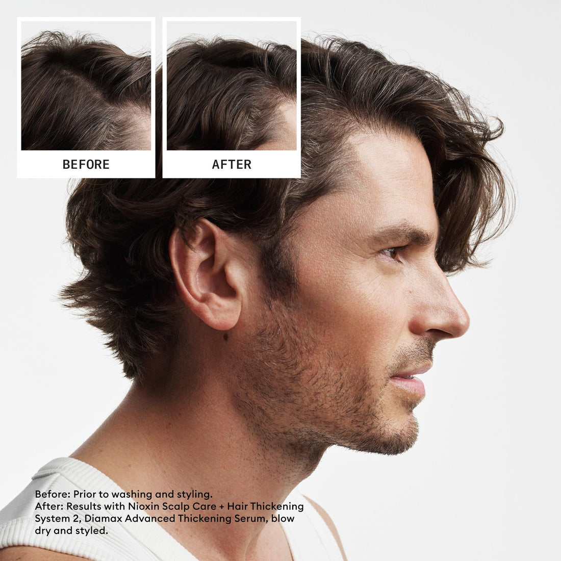 Nioxin System 2 - Hair Thickening System For Natural Hair with Progressed Thinning - Biotin & Niacinamide - Shampoo, Conditioner, Serum