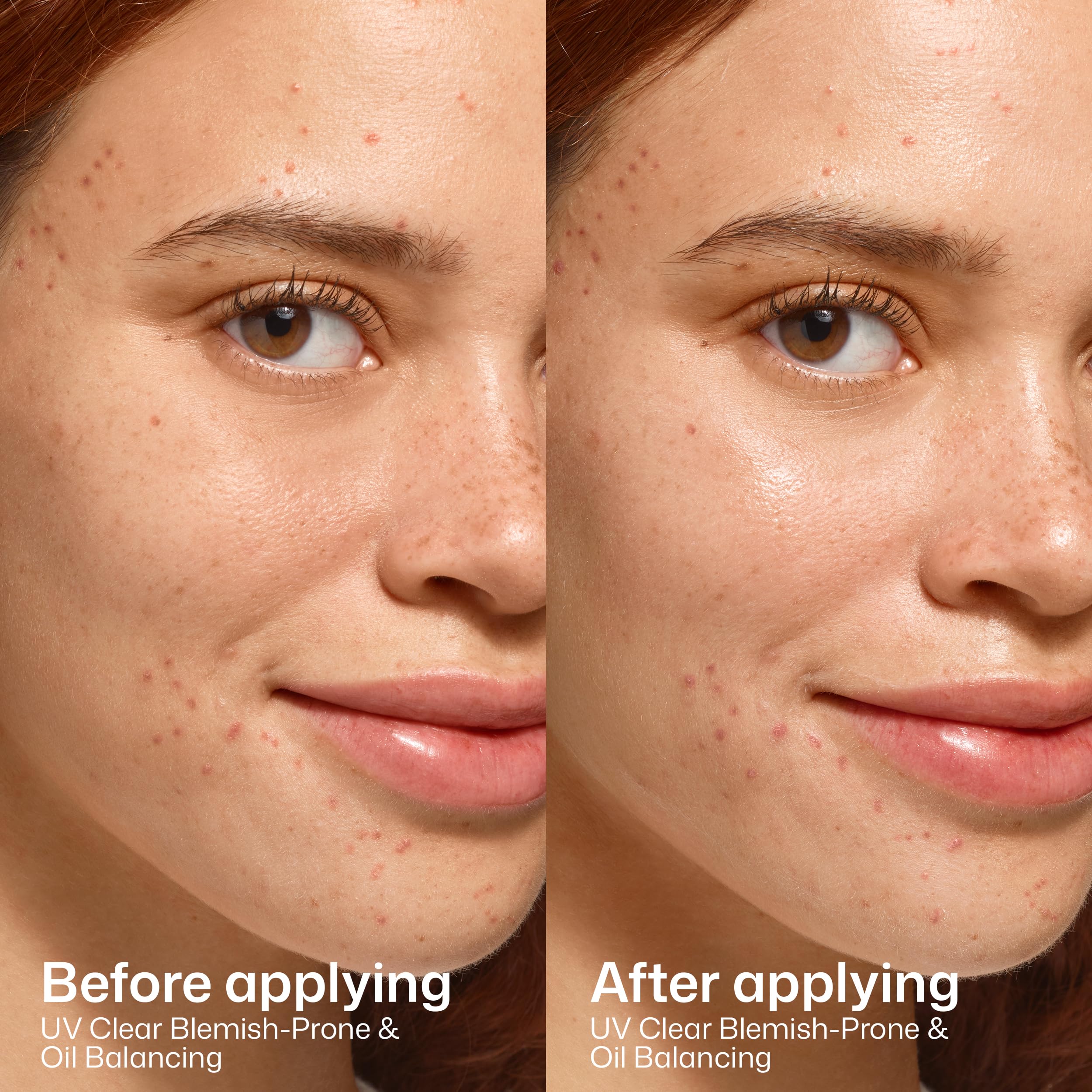 EltaMD UV Clear Face Sunscreen, Oil Free Sunscreen for Sensitive Skin with Zinc Oxide, Dermatologist Recommended Halalzen