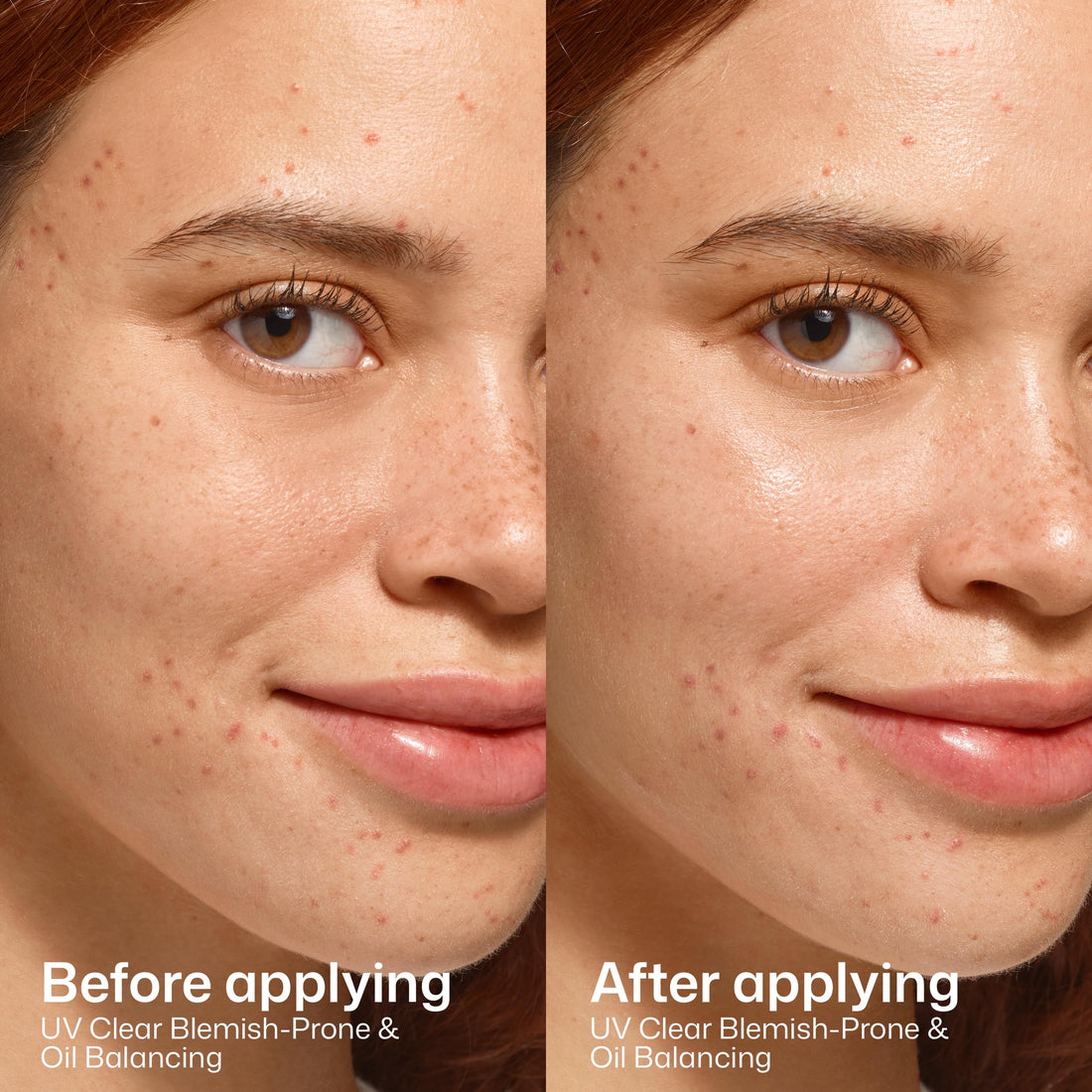 EltaMD UV Clear Face Sunscreen, Oil Free Sunscreen for Sensitive Skin with Zinc Oxide, Dermatologist Recommended Halalzen