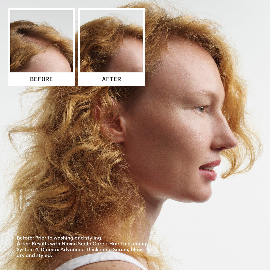 Nioxin System 4 - Hair Thickening System For Damaged Hair with Progressed Thinning - Biotin & Niacinamide - Shampoo, Conditioner, Serum