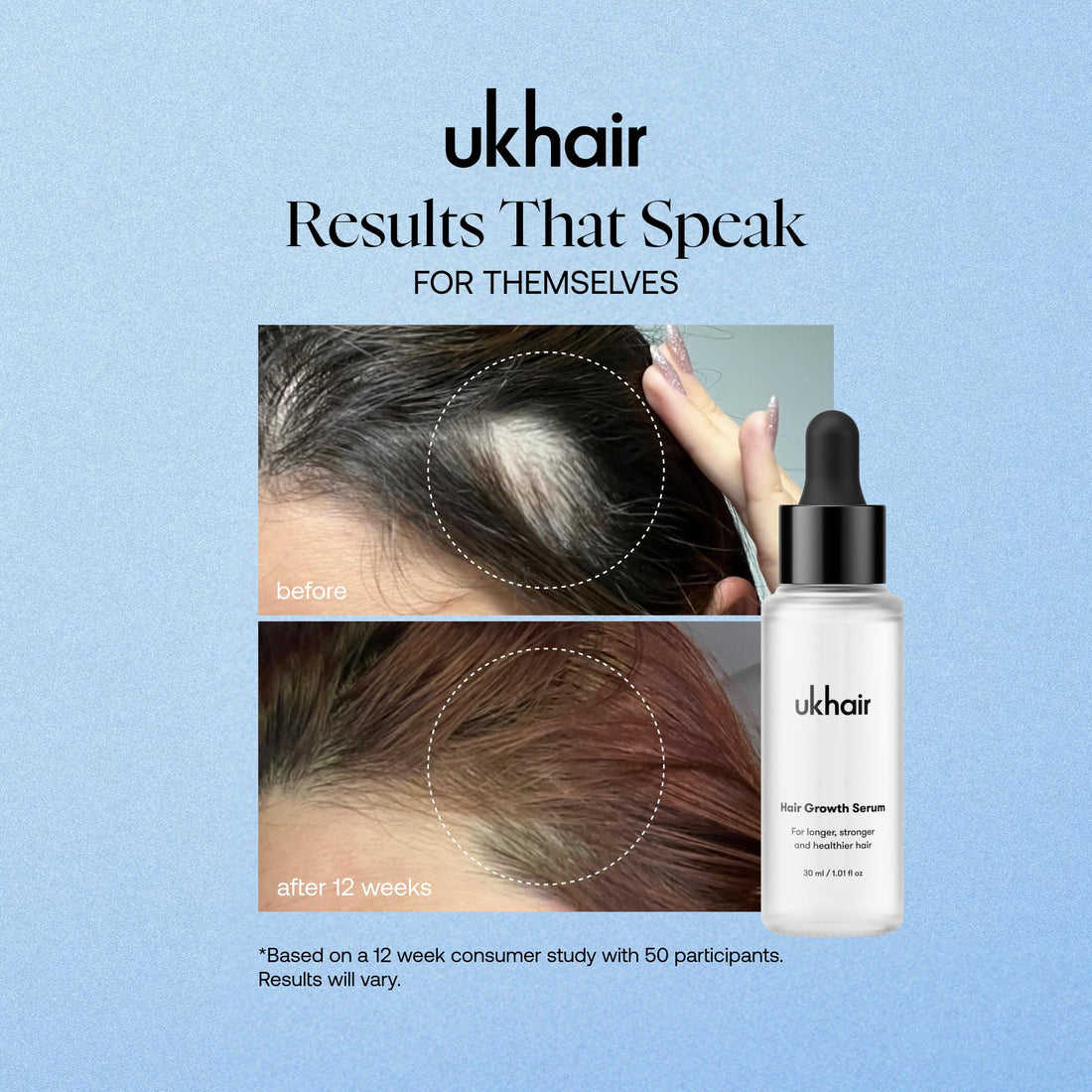 UKLASH Enhancing Hair Serum for Men and Women, Promotes Thickness in Thinning Hair & Hair Loss, Clinically Tested, Lightweight & Fast-Absorbing