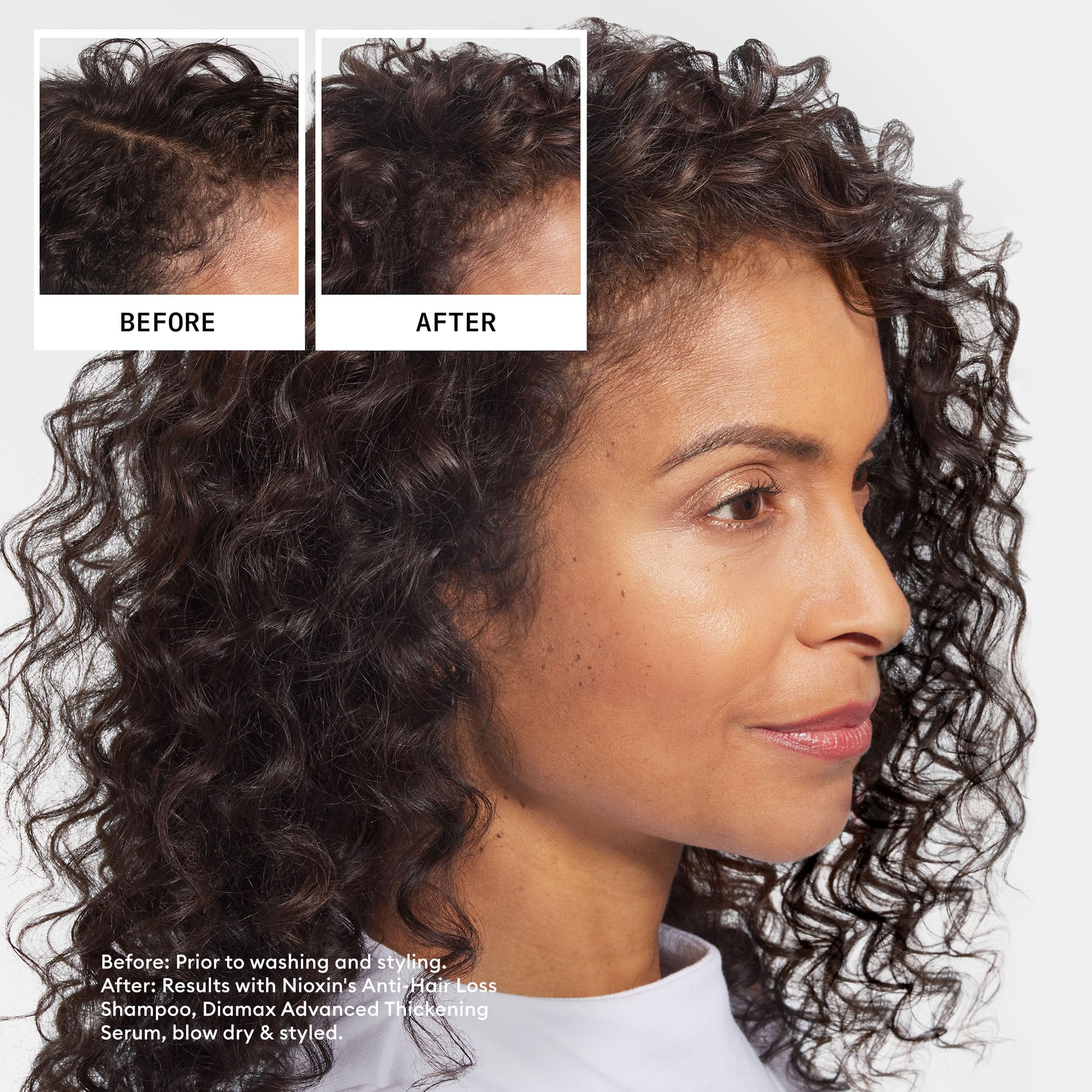 Nioxin Professional Anti-Hair Loss Niacinamide Leave-On Scalp Treatment