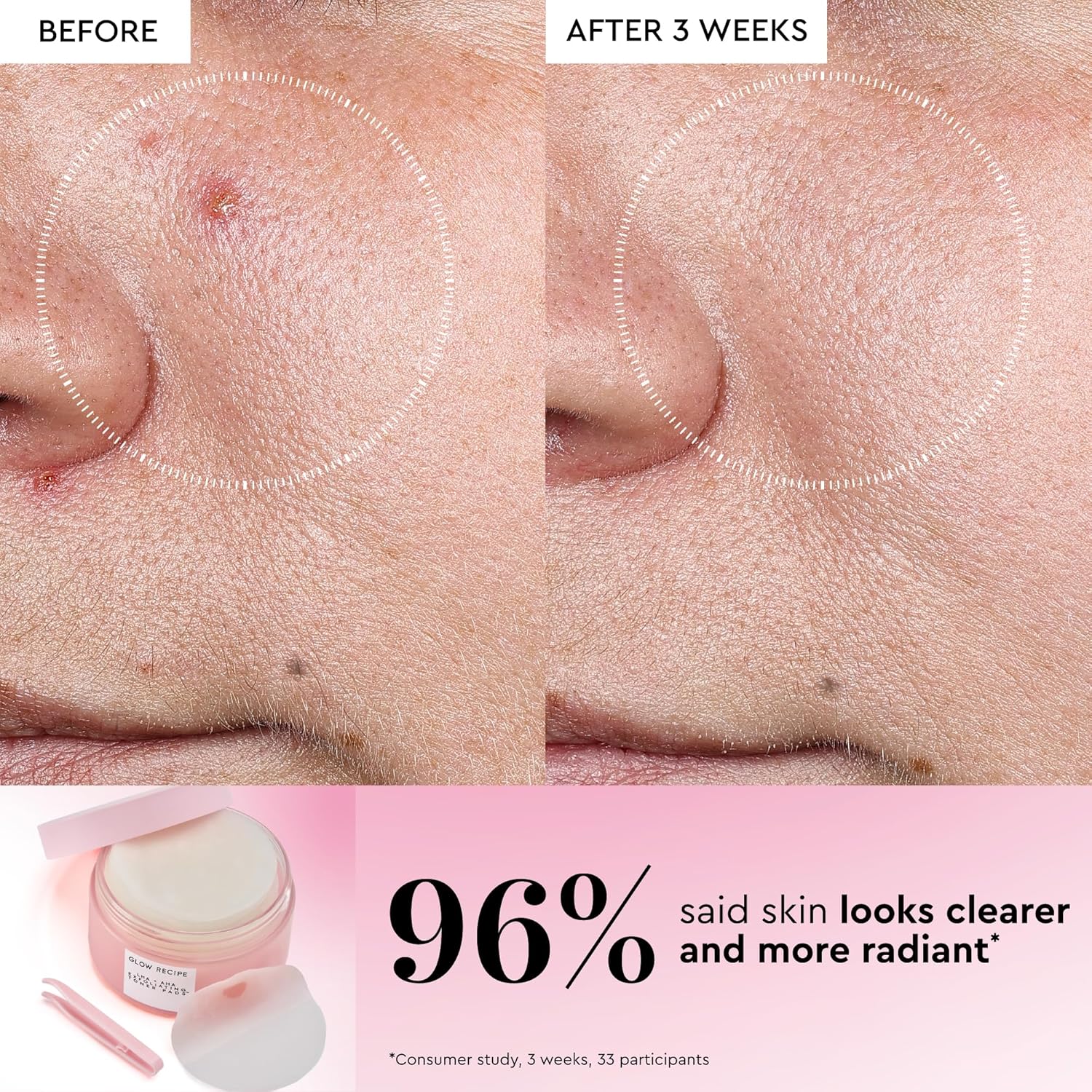 Glow Recipe LHA + AHA Toner Pads - Korean Exfoliating Toner for Face - Pore Minimizer - Hydrating Toner Pads - 5 Gentle Acids, Watermelon Enzymes, Hydrating Botanicals (60 Face Pads)