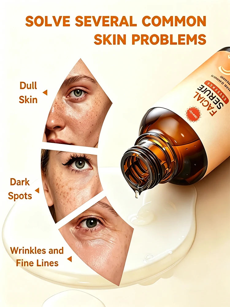 Lighten Freckles Melasma, Facial Dark Spots