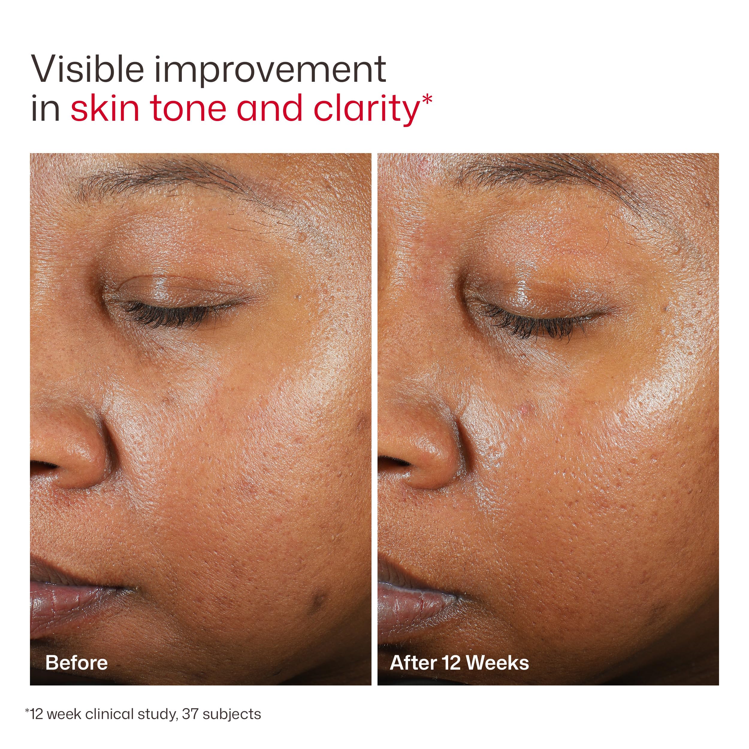 EltaMD UV Clear Face Sunscreen, Oil Free Sunscreen for Sensitive Skin with Zinc Oxide, Dermatologist Recommended Halalzen