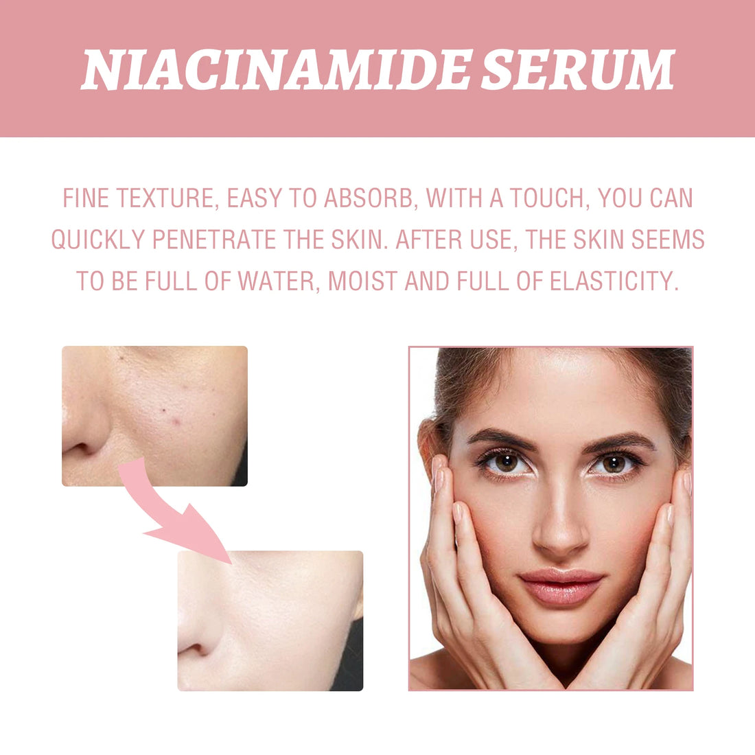 70% Niacinamide Facial Serum Hyaluronic Acid Peach Extract Hydrates Skin Minimizes Pores Refines Texture Balances Oil Restorative Face Care Serum
