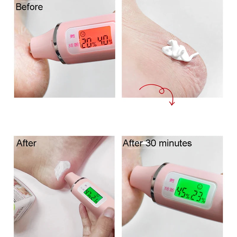 Traditional Chinese 85g Size Upgrade Oil Anti-Drying Crack Foot Cream Heel Cracked Repair Cream Removal Dead Skin Hand Feet Care
