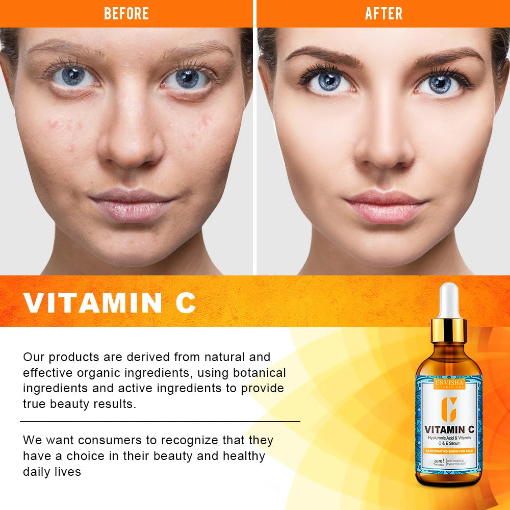 ENVISHA Face Serum Vitamin C Whitening Facial Care Skin Hyaluronic Acid Anti Aging Wrinkle Moisturizing Retinol Shrink Pores Halalzen