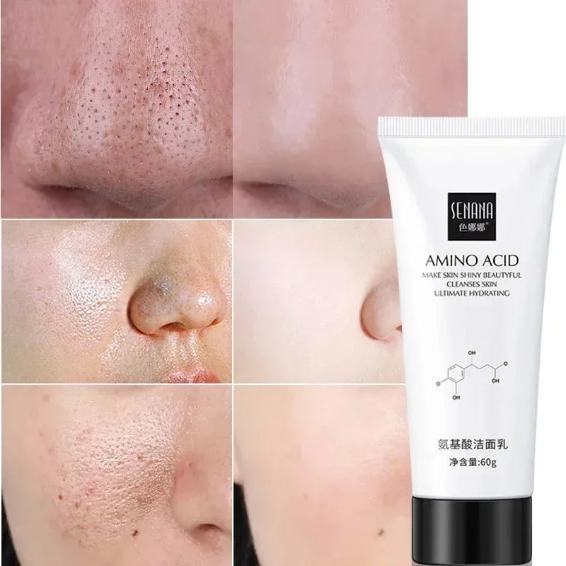 Nicotinamide Amino Acid Face Cleanser Facial Scrub Cleansing Acne Oil Control Blackhead Remover Shrink Pores Skin Care Halalzen