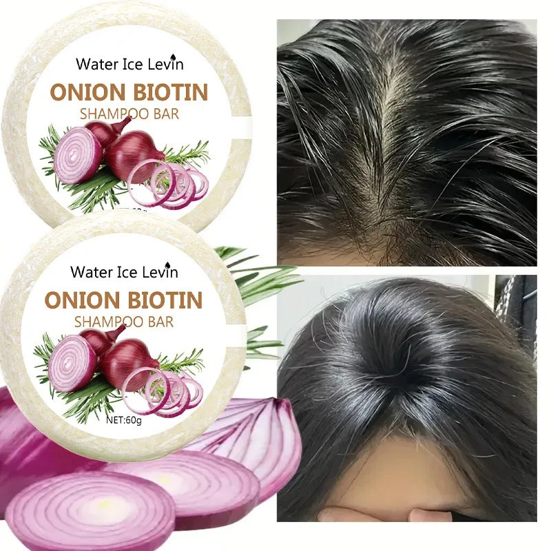 Onion and Biotin Shampoo Soap - 60g, Suitable for All Hair Types, Moisturizing and Smoothing, Rich in Rosemary Extract Halalzen
