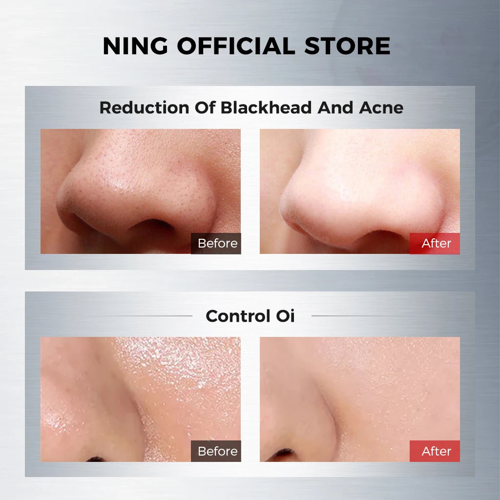 NING Amino Acid Facial Cleanser – Gentle, Hydrating Deep Cleansing Face Wash for Sensitive Skin Halalzen