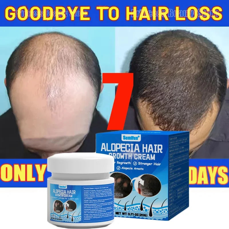 Fast Hair Growth Cream Anti Hair Loss Prevent Baldness Scalp Treatment Repair Roots Beauty Health Hair Care For Men Women