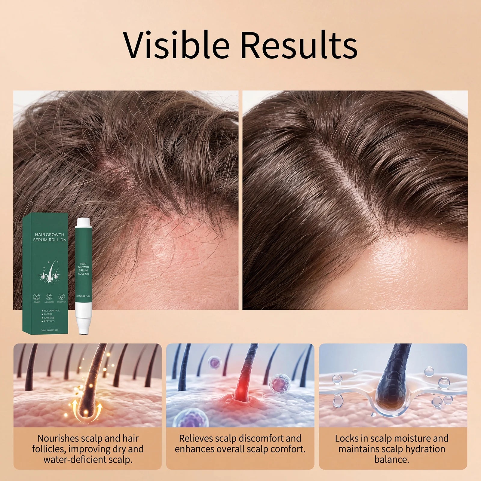 20ml Rosemary Oil Hair Growth Serum Roll-on Biotin Caffeine Peptides Scalp Massager Anti Hair Loss Thinning Treatment Spray