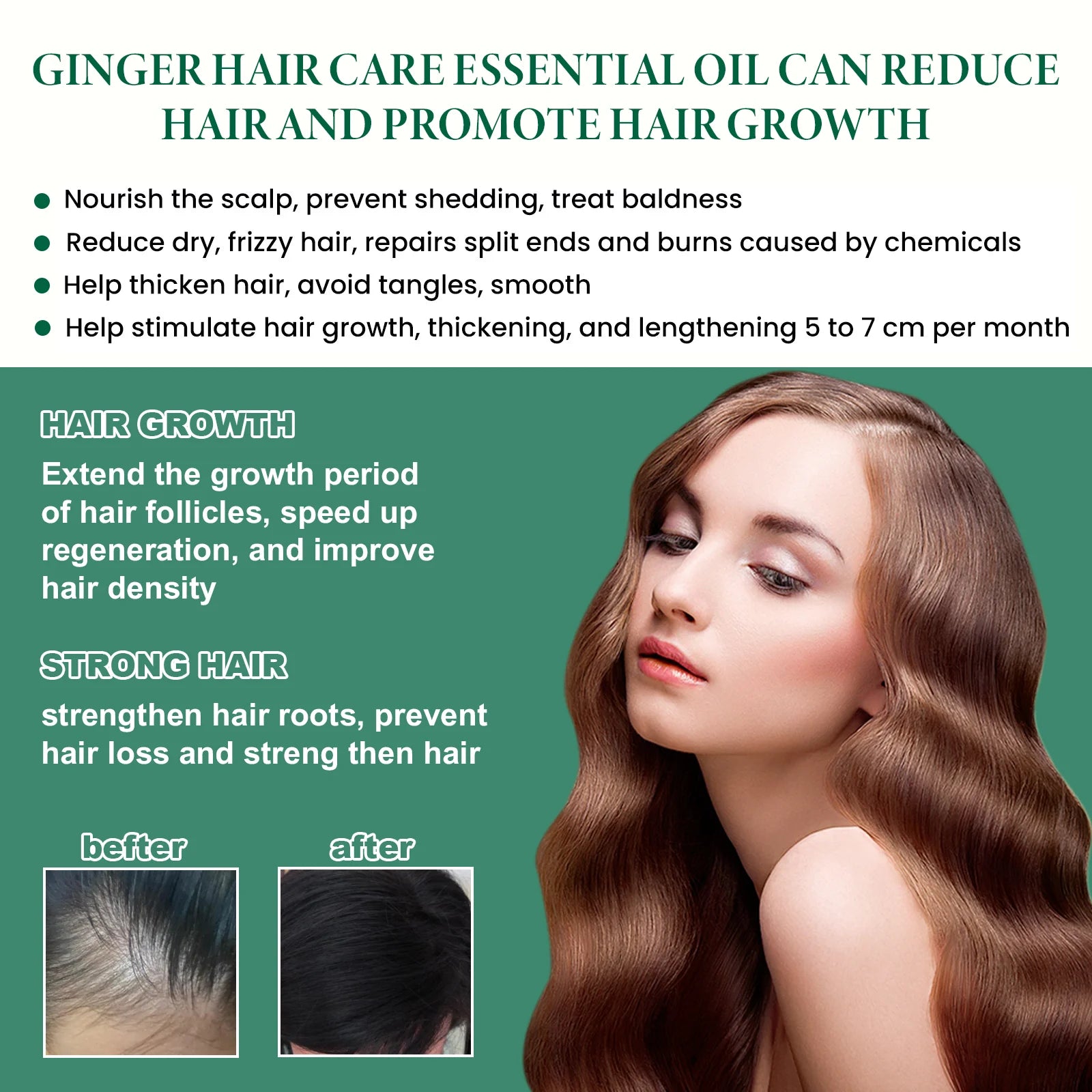 Hair Growth Essence Oil Anti Hair Loss Prevent Baldness Treatment Fast Nourish Scalp Ginger Hair Growth Oil Hair Care