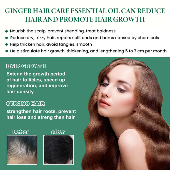Hair Growth Essence Oil Anti Hair Loss Prevent Baldness Treatment Fast Nourish Scalp Ginger Hair Growth Oil Hair Care