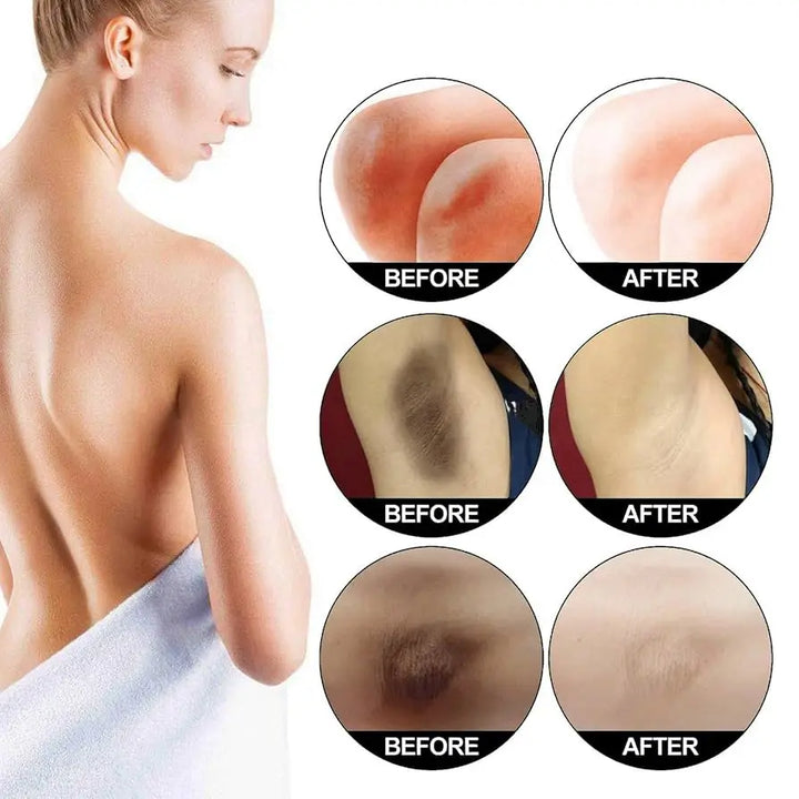 Body Whitening Cream Private Parts Underarm Dark Skin Bleaching Serum Niacinamide Whitening Lighten Dark Spots Snow Bleach Cream