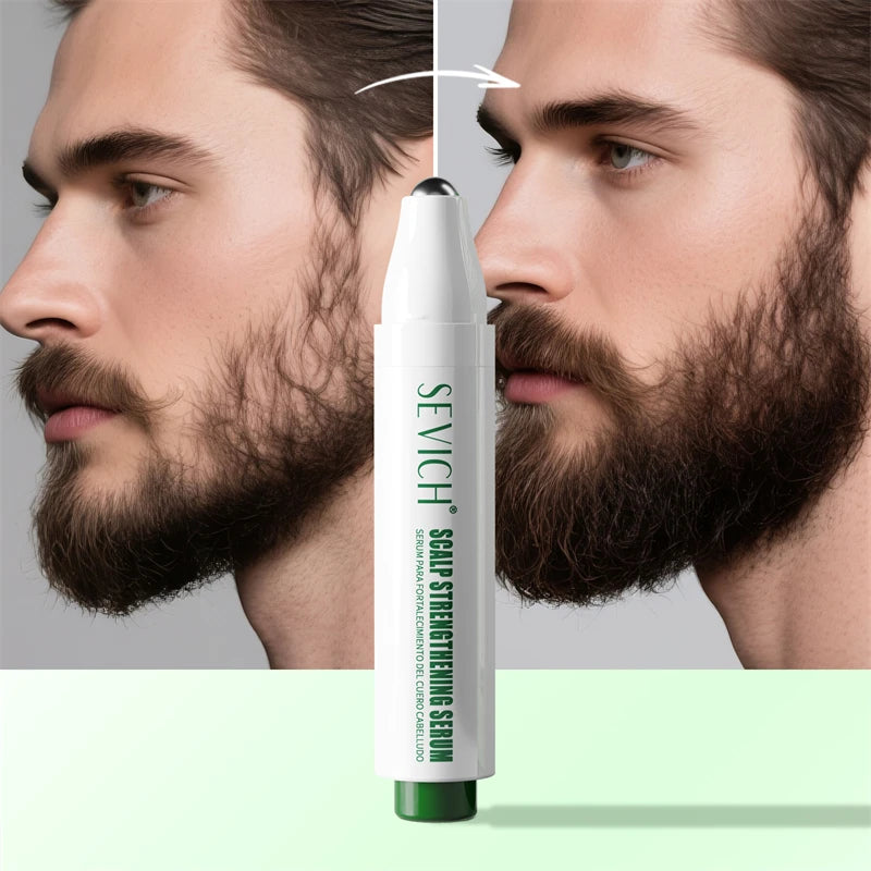 Rosemary Hair Growth Roller Essence Improves Scalp Health Stimulates Follicle Activity Reduces Hair Breakage Increases Density