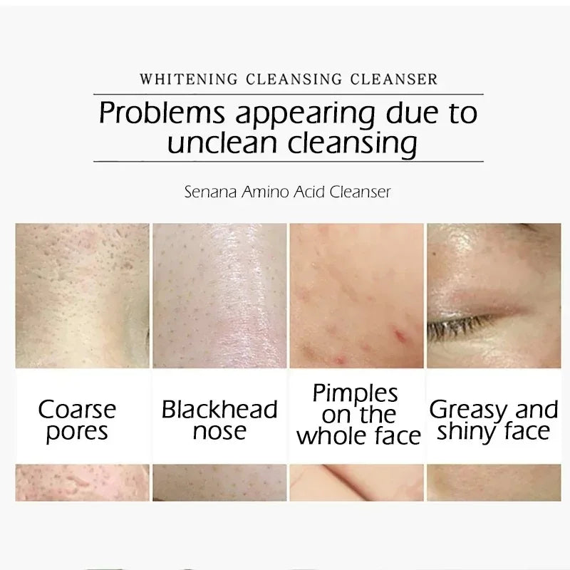 Nicotinamide Amino Acid Face Cleanser Facial Scrub Cleansing Acne Oil Control Blackhead Remover Shrink Pores Skin Care Halalzen