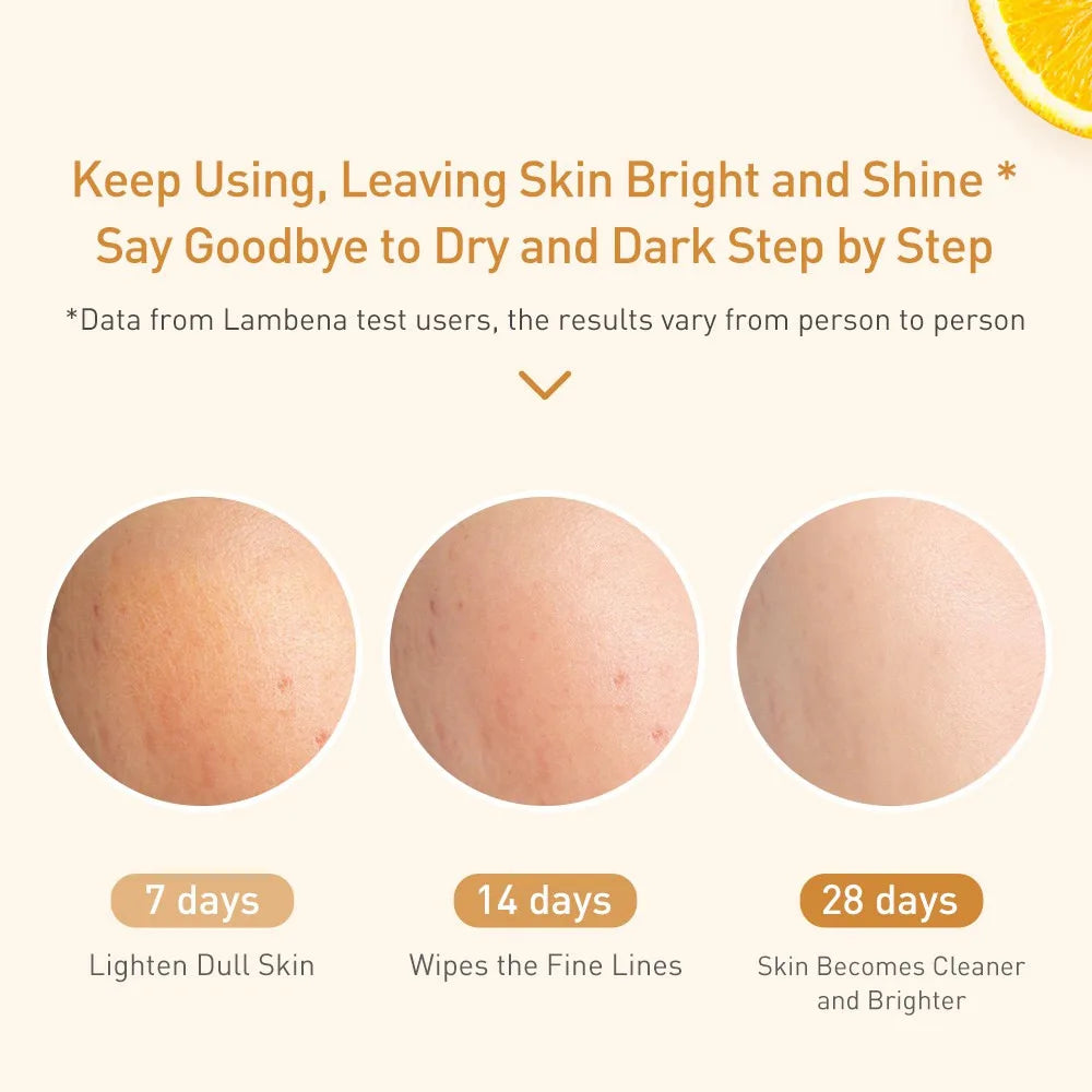 LANBENA Vitamin C Serum For Face Cream Whitening  Moisturizing Freckles Remover Fades Spots Skin Care 15ml