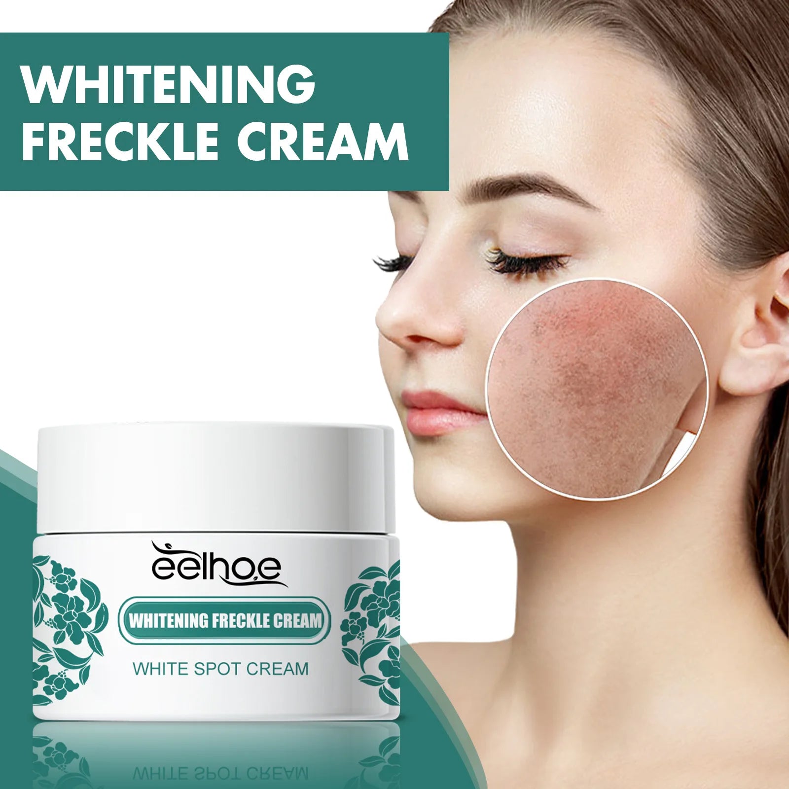 Whitening Freckle Cream Remove Acne Age Spot Melanin Sunburn Repair Anti Pigmentation Even Skin Tone Brighten Melasma Remover