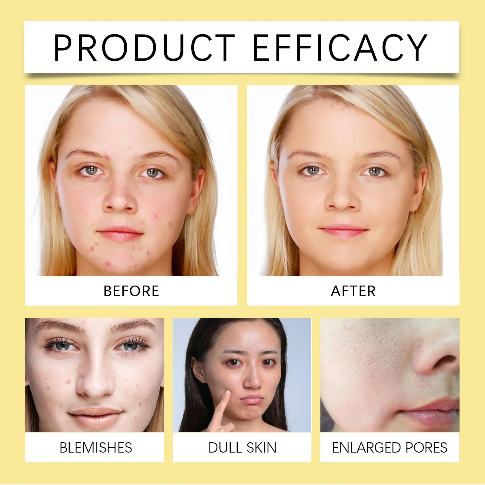 Niacinamide Whitening Cleanser For Deep Cleansing Moisturizing & Non Tightening Face Hydrating Whitening & Moisturizing Cleanser Halalzen