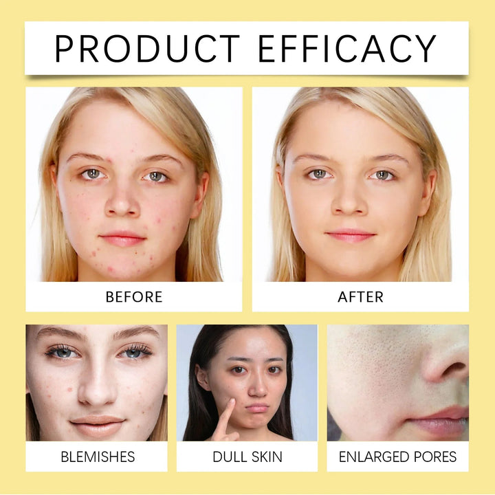 Niacinamide Whitening Cleanser For Deep Cleansing Moisturizing & Non Tightening Face Hydrating Whitening & Moisturizing Cleanser Halalzen